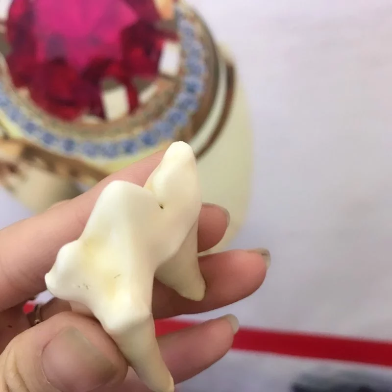 răng hổ tam sơn chưa bọc